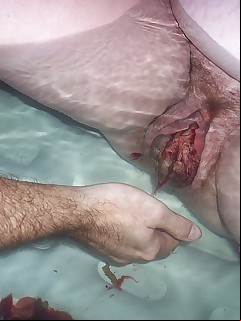 Pregnant Pussy Pics